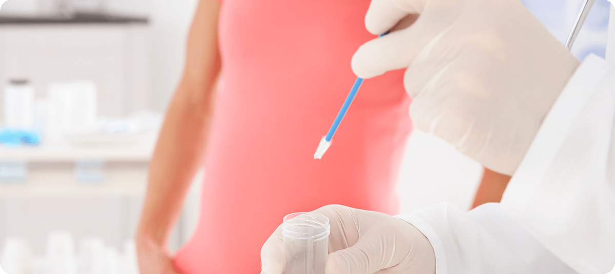 Blog-Bürstchen für HPV Abstrich